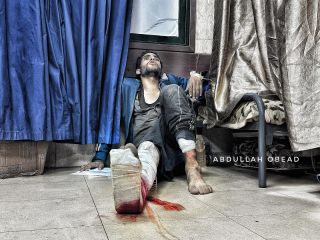 |#صورة || مُصاب داخل مستشفى #شهداء_الأقصى جراء قصف إسرائيلي في #دير_البلح وسط #قطاع_غزة
#غزة #اكسبلور...