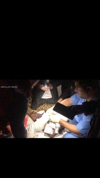 |طبيب يجري جراحة لقدم جريح بأضواء وكشافات الهواتف بعد فصل الكهرباء في مستشفى الإندونيسي شمال قطاع...