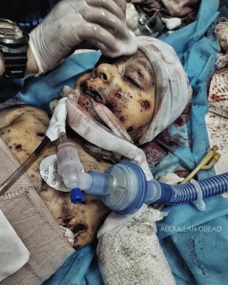 |#صورة|| وما زال أطفالنا يصارعون الحياة 

#غزة #اكسبلور  #غزة_الان #غزة_تحت_القصف #غزة_تُباد 
#gazanation #gaza #gaza_war...