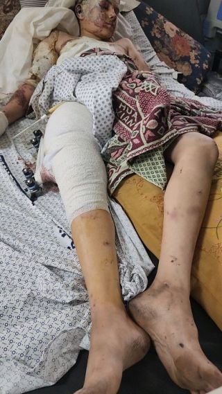 |أحمد خالد العسكري ١٣ عاما فقد اخوته الستة وامه وبقى له والده بعد ان قصفت الطائرات الاسرائيلية منزلهم فوق...