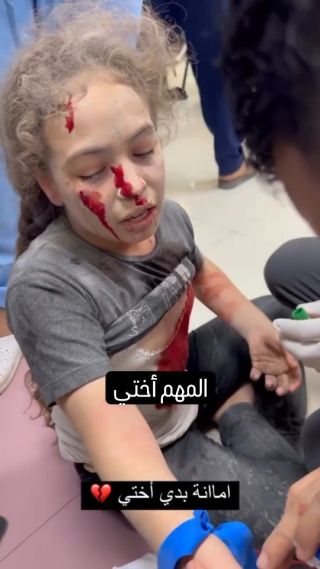 |"أنا مش مشكلة.. المهم أختي" .. صرخات طفلة فلسطينية مصابة جراء القصف الهمجي الإسرائيلي المتواصل على...