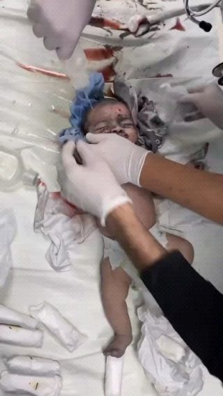 |هذا الطفل إحدى بنك أهداف الجيش الإسرائيلي.. العالم يشاهد عن كثب بصمت "كفرتُ بإنسانيتكم" .
This child is one of the Israeli...