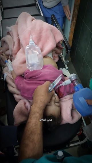 Ù…Ø¤Ù„Ù… ...Ø·ÙÙ„Ø© Ø£ØµÙŠØ¨Øª Ø¨Ø¬Ø±Ø§Ø­ Ø®Ø·Ø±Ø© Ø¬Ø±Ø§Ø¡ Ù‚ØµÙ Ù†Ø§Ø²Ø­ÙŠÙ† Ù‚Ø¨Ù„ Ø³Ø§Ø­Ù„ Ø¨Ø­Ø±...