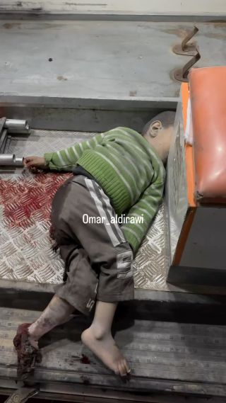 Peace be upon the children of Gaza
سلامٌ على أطفال غزة 
#غزة_تحت_القصف #freepalestine #reels #instagram 
@omar_aldirawi