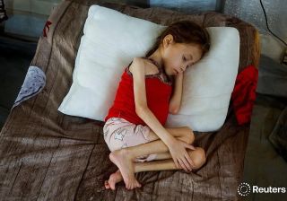 A doctor checks Jana Ayad, a malnourished  @m.palestine girl, as she receives treatment at the International Medical Corps field hospital, in Deir Al-Balah in the southern #Gaza Strip, June 22, 2024.